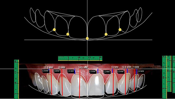 Planejamento digital do caso em 3D