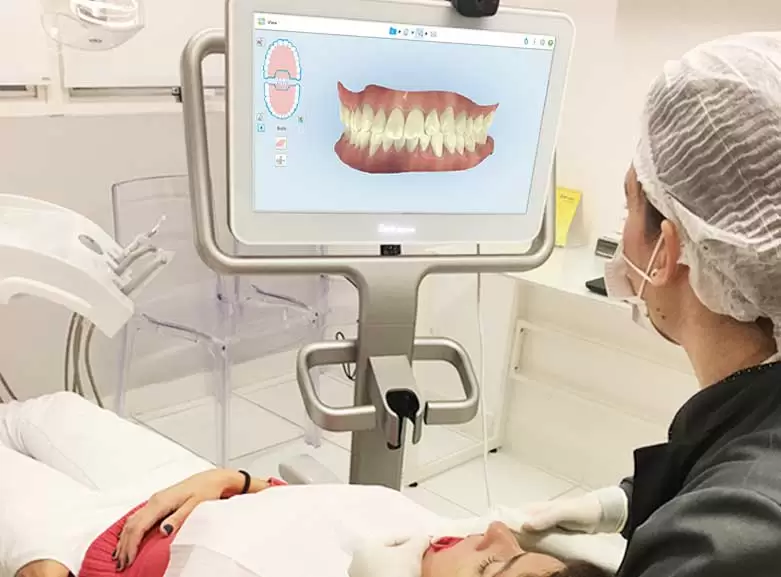 Escaneamento 3D intraoral — visualização digital do sorriso
